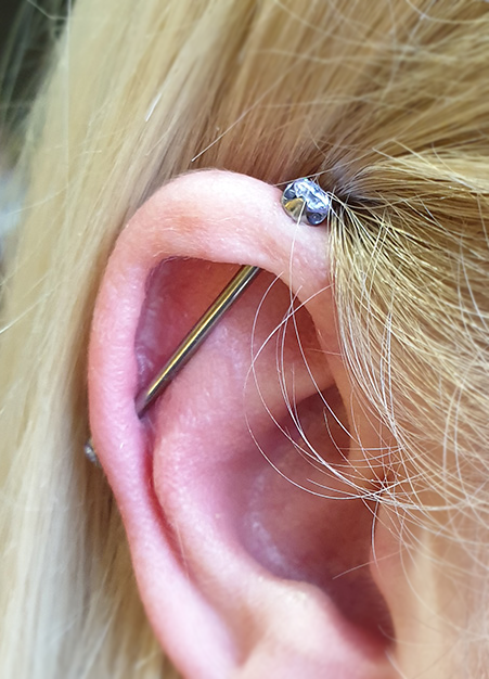 a healed industrial piercing with big cz gems threaded on the ends from Anatometal