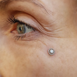 A left eye showing a white gold virtue from Anatometal in a surface dermal piercing